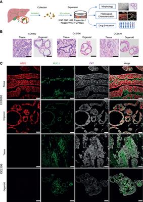 Lapatinib Suppresses HER2-Overexpressed Cholangiocarcinoma and Overcomes ABCB1– Mediated Gemcitabine Chemoresistance